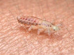 if your child has head lice, this is what he looks like