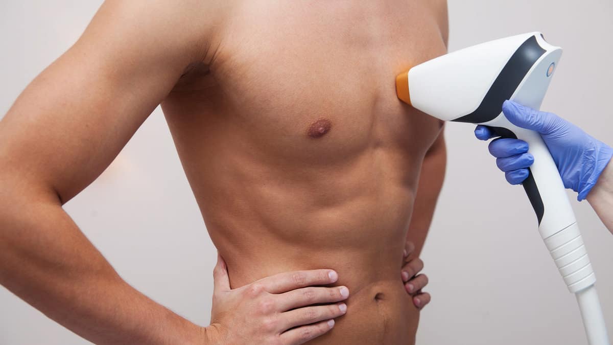 A Complete Guide to Laser Hair Removal